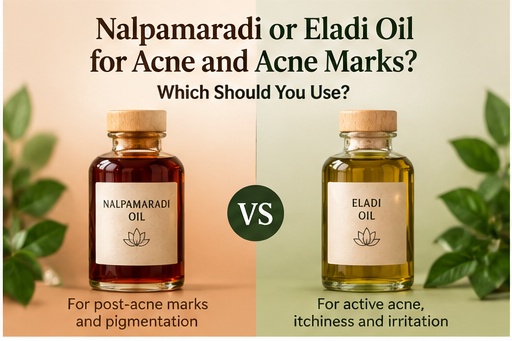 Nalpamaradi vs Eladi oil for active acne and acne marks